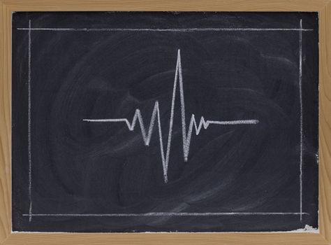 signal graph sketched with white chalk on blackboard with eraser patterns