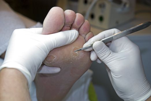 Bezoekje bij de pedicure