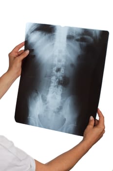 female doctor looking at a xray with white background