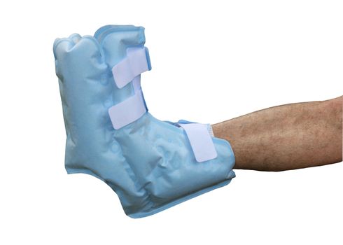 soft boot cast on right foot isolated with clipping path at this size