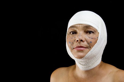 Plastic surgery. Mature woman over black.