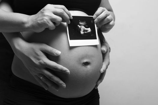 A shot of a pregnant woman with husband holding ultrasound scan of unborn child