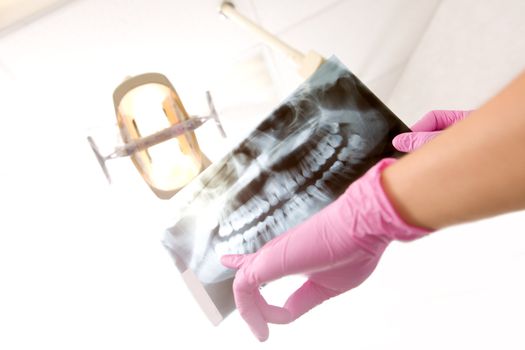 A dentist's hand holding up an x-ray for the patient