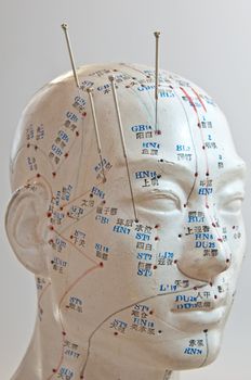 Acupuncture of the head