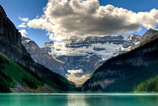 view of lake louise at banff national park in alberta canada