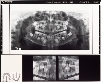 children dental scan