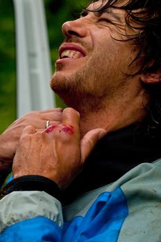 Portrait of kayaker bruise the hands, Norway, summer 2010