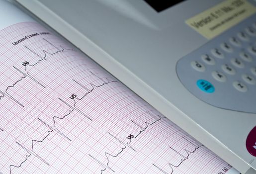 Medical equipment: heart analysis, ECG graph.