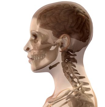 X Ray image of the inside of a womens head.