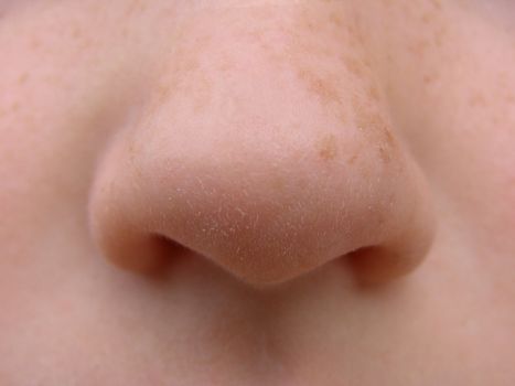 on this children's nose with the freckles is the clean pink skin, not damaged with years by wrinkles and pimples. 