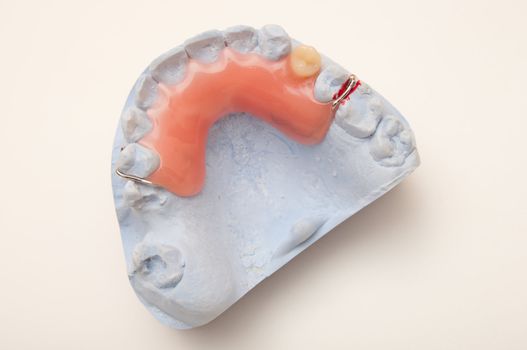 Lower jaw with dental impression  back view