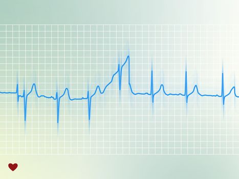 Electrocardiogram of a healthy heart (blue line on soft background)