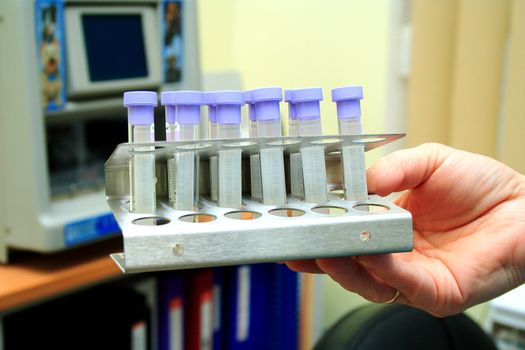 hand holding test tubes in the clinic