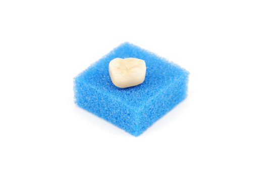 bonded crown non precious of lower right six tooth (on a blue sponge)