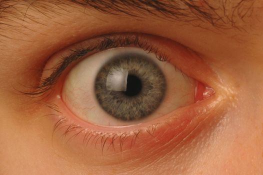 Close up of wide-eyed eyeball