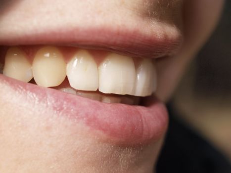 Close up of woman teeth