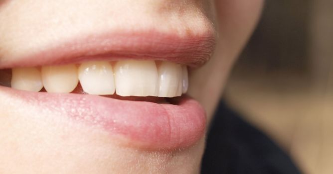 Close up of woman teeth
