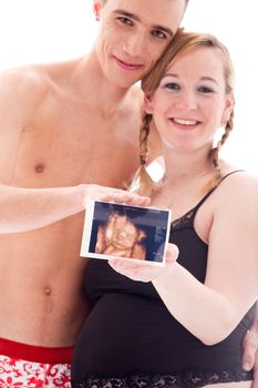 Young lovely caucasian couple expecting their baby