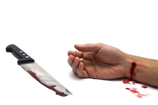 A bloody knife and a cut wrist, isolated on white. This image has innumerous uses like accidents, domestic violence, suicide, murder, etc...