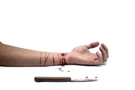 A bloody knife and a cut wrist, isolated on white. This image has innumerous uses like accidents, domestic violence, suicide, murder, hate, etc...
