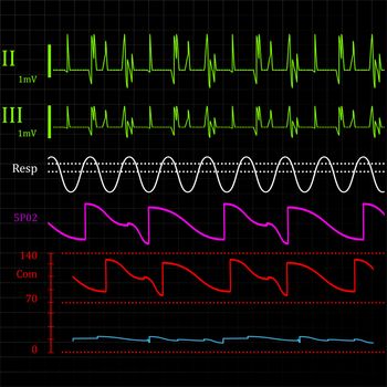 Physiologic monitor, abstract background illustration