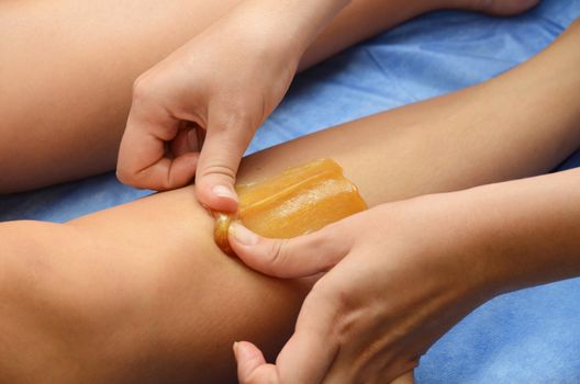 Sugaring: epilation with liquate sugar at legs.