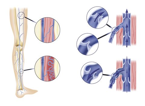 diagram section illustration of leg artery and aortic valves