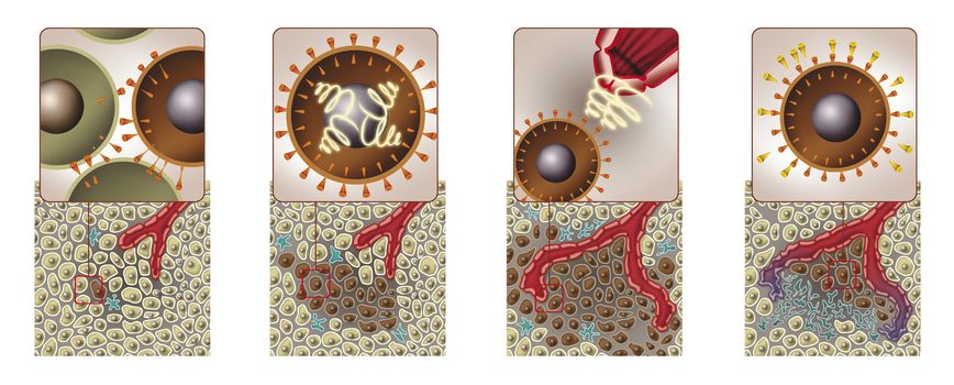 diagram illustration of cancer attacking cells