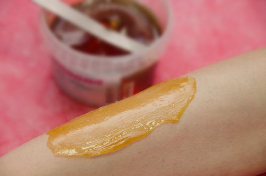 Sugaring: epilation with liquate sugar at legs. It is less painful hair removal with wax replacement