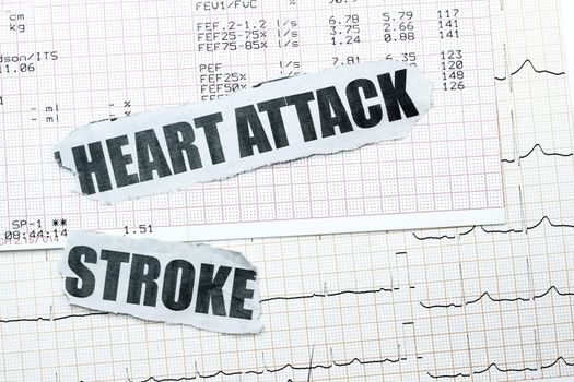 Heart attack and stroke with chart concept- many uses in the insurance industry.
