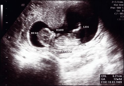 Ultrasound scan of a new life baby in mother womb