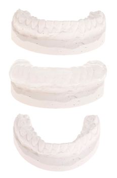 cast model with gum shield or mouth guard (isolated on white background)
