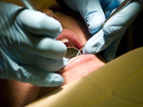 A dentist checks the backs of the teeth of a patient in his office. Closeup of the doctor's hands holding a mirror and a probe in her mouth