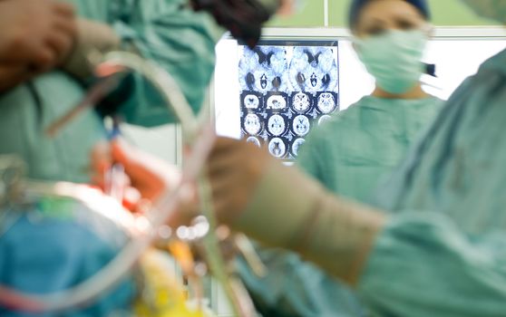 Blurred figures of people in medical uniforms performing brain surgery, focus on x-ray