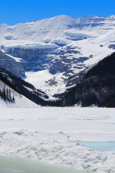 Lake Louise in Banff National Park, Alberta Canada