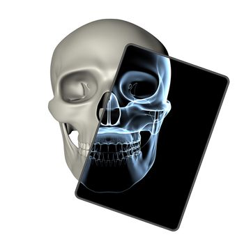 rendered human skull with a bluish x-ray image in a frame - front view