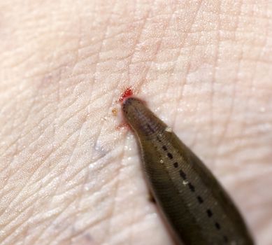 Leech sucking blood from a leg at tropical rainforest, Malaysia.