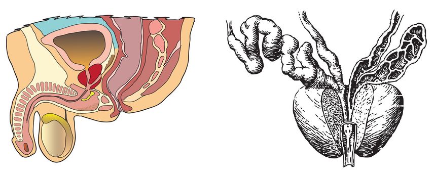 Visual aids for prostate diseases. Vector illustration.