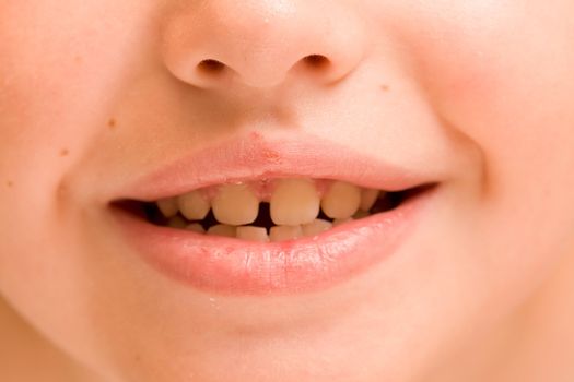 Children's smile close up