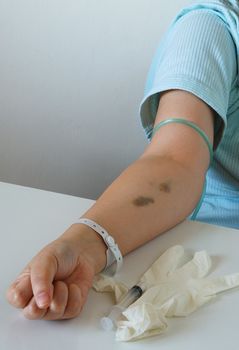 Arm of female patient with  hospital  wristband in laboratory 