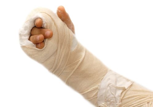 broken arm bone in a cast and bandages over white background isolated