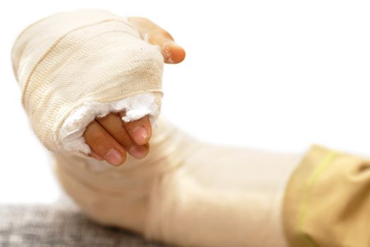 broken arm bone in a cast and bandages over white background isolated