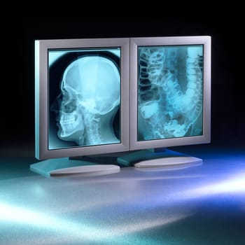 Large X-rays viewed on hospital high end monitors