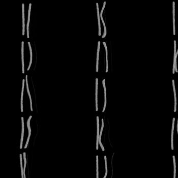 strands of human chromosomes