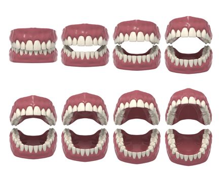 3d rendered dental prosthesis