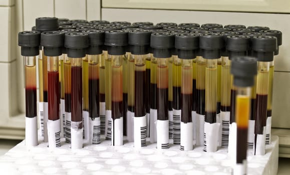 Medical test tubes with blood in holder
