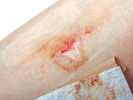Physical human injury wound medicine healthcare