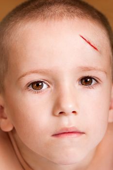 Physical injury blood wound skin human child pain