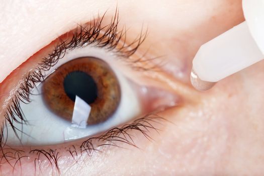 Medicine healthcare liquid eyedropper on human eye