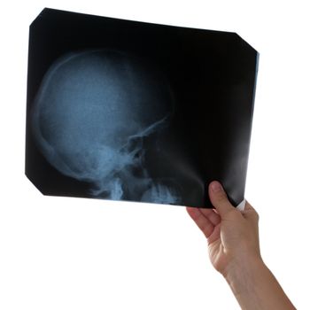 X-ray medicine film of human skull bone in hand